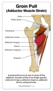 Superficial structures of the groin. Groin Pain Clarity And Solutions Sparta Science