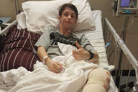 Maybe you would like to learn more about one of these? Adam Bart In Hospital With His Broken Leg Abc News Australian Broadcasting Corporation