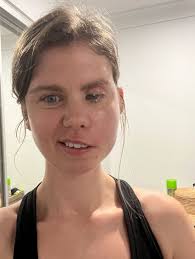 I thought I was just dizzy — but I lost the ability to walk and talk