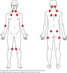 Image result for Tender Point