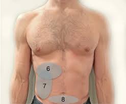 The human abdomen is divided into quadrants and regions by anatomists and physicians for the purposes of study, diagnosis, and treatment. Us Of Right Upper Quadrant Pain In The Emergency Department Diagnosing Beyond Gallbladder And Biliary Disease Radiographics