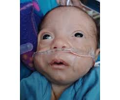 Theo Idea Robinson Obituary (2025)