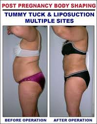 Pin On Health And Fitness