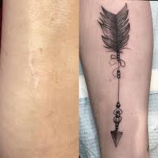 Some tattoo artists and customers are so pleased with scar coverage results that they share before and after images of their tattoo cover up transformations. Scar Tattoo