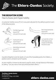 Image result for Hypermobility Signs