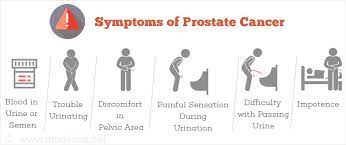 Next to skin cancer, prostate cancer is the most common cancer in american men. Prostate Cancer Cancer Of Prostate Incidence Prevention Causes Symptoms Treatment