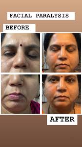 Top Pain Management Specialists in Sindhudurg Nagari Mdg