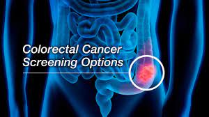 Colorectal Cancer: What You Should Know About Screening | Fda