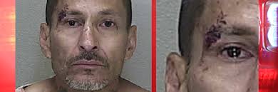 Gas station gash: He hit worker in the face with M&Ms but faces felonies  for fighting cop