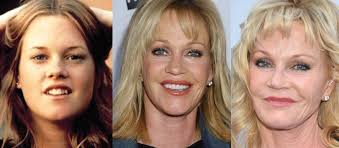 Melanie griffith may be rare among hollywood actresses in acknowledging what's long been suspected: Melanie Griffith Plastic Surgery Before And After Pictures 2021