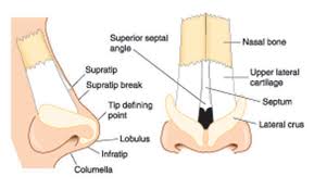 Nasal Fractures and Closed Nasal Reduction