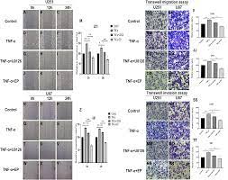 Ethyl Pyruvate Inhibits Glioblastoma Cells Migration And Invasion Through Modulation Of Nf Kb And Erk Mediated Emt Peerj