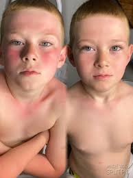 Red Squirrel Sighting in Polk County, MO