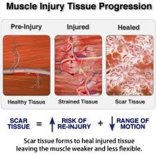 Another hit to the head. Massage Scar Tissue And Dundas Valley Massage Facebook