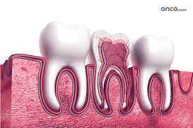 Trouble swallowing is one of the early reported warnings signs and symptoms of throat cancer. Oral Cancer Symptoms And Signs Onco Com