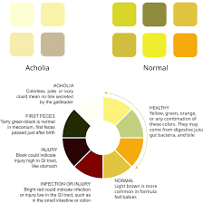 Image result for acholic stools human