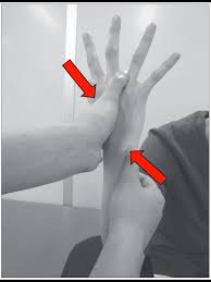 Image result for Elson Extensor Tendon Test