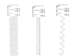 Altitude consulting uses liquid chromatography to test for the 8 most common cannabinoids in hemp: Https Www Sandvik Coromant Com Sitecollectiondocuments Downloads Global Catalogues De De C 2940 137 Pdf