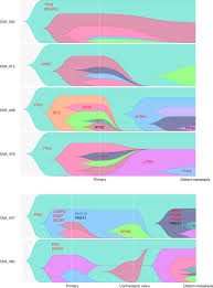 Ovarian cancer is a malignant tumour in one or both ovaries. Genetic Heterogeneity And Evolutionary History Of High Grade Ovarian Carcinoma And Matched Distant Metastases British Journal Of Cancer