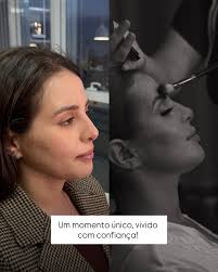 Histórias reais, resultados naturais e mulheres que decidiram se  escolher!✨🤍