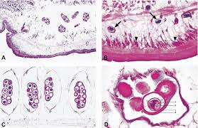 Each segment of its strobilus has two sets of male and female reproductive organs (proglottids). Dipylidiasis