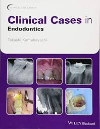Download In Pdf Clinical Cases In Endodontics Clinical Cases Dentistry R A R Endodontics Ebook Clinic