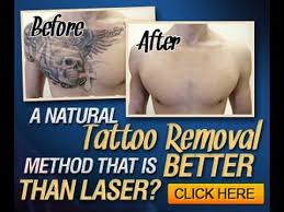 This is a review for tattoo in baton rouge, la: How To Get Rid Of A Stick And Poke Tattoo