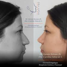 DR. DARWIN SERRANO. OTORRINOLARINGÓLOGO. Reviews