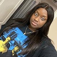 Love Burns: Lake Hill Mini Series by Ada Beck