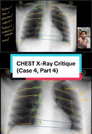 Image result for XRay Interpretation