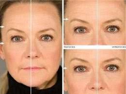 ageLOC Galvanic Spa by Nu Skin