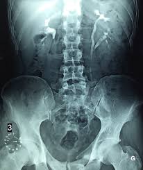 The Pan African Medical Journal Image Quiz