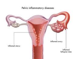 Afectiunile acestea mai sunt denumite si boli venerice. Bolile Cu Transmitere Sexuala Bts Imagini Si Cuvinte La Farmacistu