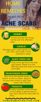 35 Efficacious Home Remedies To Get Rid Of Acne Scabs Homemade Acne Treatment How To Get Rid Of Acne Acne Scab