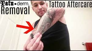 Check spelling or type a new query. Tattoo Aftercare Tatu Derm Explanation Removal Youtube