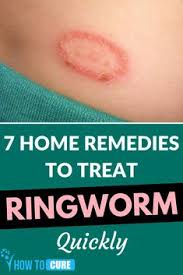 This is necessary to completely kill the ringworm or it will just come back later if it's not completely killed off. 18 Home Remedies For Ringworm Skin Ideas Home Remedies For Ringworm Ringworm Ringworm Remedies
