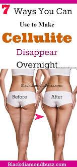 Pin On Cellulite Removal