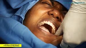 Dentist recommended · foam formula cools gums · reverses gingivitis Infected Wisdom Teeth Removal Wisdom Tooth Extraction Youtube