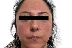 San José del Rincón