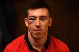 New photos show Adam Beard's awful facial injuries after Wales v Australia  red card