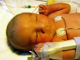 Bayi kuning adalah kondisi ketika kadar pigmen kuning yang disebut bilirubin pada tubuh terlalu tinggi. Bayi Kuning Penyebab Gejala Dan Cara Penanganannya Theasianparent Indonesia