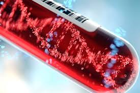 The pancreas is an organ that releases enzymes involved with digestion, and hormones to regular blood sugar levels. Can Blood Tests Show Lung Cancer Lung Cancer Pintas Mullins Law Firm