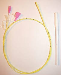 Gastric bypass and lap band procedures. Nasogastric Ng Tube Placement Oxford Medical Education