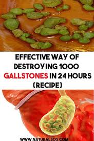 Effective Way Of Destroying 1000 Gallstones In 24 Hours Recipe Gallstones Healing Tea Recipes Recipes