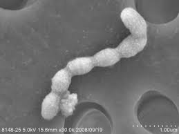 Streptococcus Mutans An Overview Sciencedirect Topics