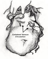Pdf A Case Of Superior Vena Cava Syndrome In Pregnancy Within A Developing Country In Sub Saharan Africa Semantic Scholar