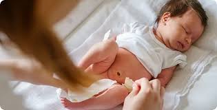 Image result for Neonatal Circumcision