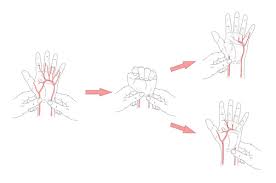 Image result for Allen Test