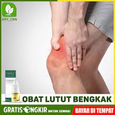 Maybe you would like to learn more about one of these? Obat Lutut Bengkak Akibat Jatuh Berisi Cairan Herbal Propolis Sm Brasil Bisa Cod Di Cirebon Shopee Indonesia