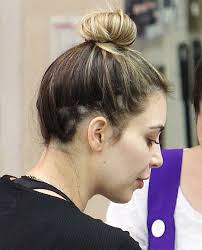 Alopecia areata, telogen effluvium, and trichotillomania. Kim Kardashian Experiencing Stress Related Hair Loss